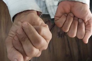 Hand - Wrist - Elbow